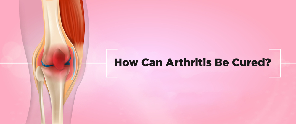 Ayurvedic treatment for Arthritis